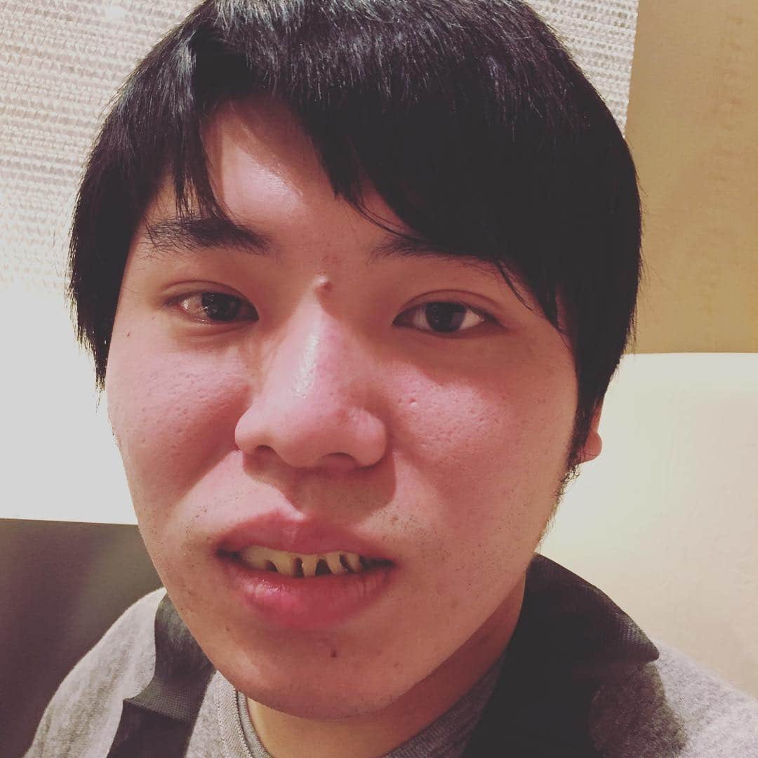 間宮祥太朗さんのインスタグラム写真 - (間宮祥太朗Instagram)「😬 牙かよ」2月12日 16時38分 - shotaro_mamiya
