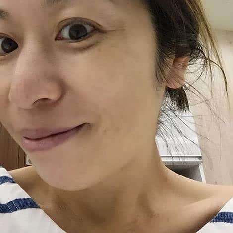 オラクル美容皮膚科東京新宿院のインスタグラム