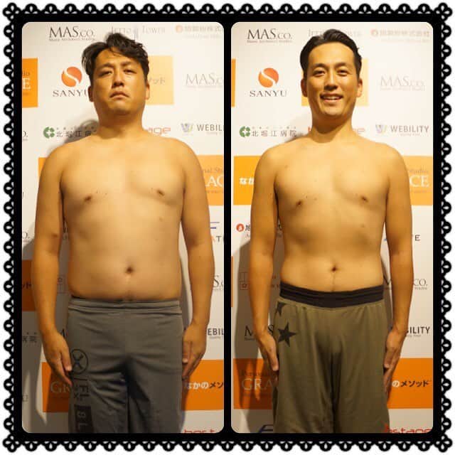 陥没乳首　芸能人 