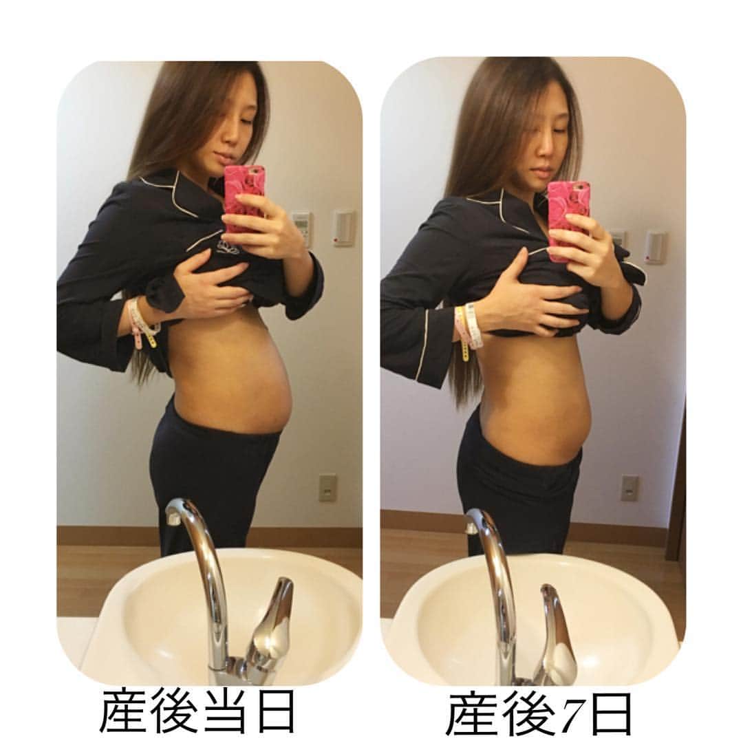 芹澤明日香さんのインスタグラム写真 - (芹澤明日香Instagram)「産後のお腹ちゃん🙋🏻 ・ 左は出産した当日のお腹で 右は退院する7日め！！！ ・ やっぱり産後はベビさんがいただけに もう1人いるみたいに出てるね( ¨̮ ) 1週間たつとだいぶひっこんだかな！！ ・ ダイエットはまだまだ先までできないし 骨盤矯正も本格的にはできないから ワコールのベルトを産後すぐからつけれるのを ずっとつけてる！！ ・ ちなみにお腹ぽよぽよのときにうつぶせになると 不思議な感じがしたよ🤗 ほんと妊娠出産って神秘的だよね(´•̥̥̥ω•̥̥̥`)♡ ベビさん見るたびに、、、 この子がお腹にいたんだなぁってなんかね ウルウルしちゃう😢😭😭 ・ コメントでこれから出産って方が多かったから みなさん頑張ってほしい❤️ お腹にいるベビちゃんとともに♡ʾʾ♡ʾʾ ・ #産後 #産後のお腹 #出産#出産レポ#育児 #育児レポ #子育て #新米ママ #女の子ママ #mybabygirl #babygirl #instababy #instagood #instalike #sweetmommy」12月13日 19時36分 - 1219asuka