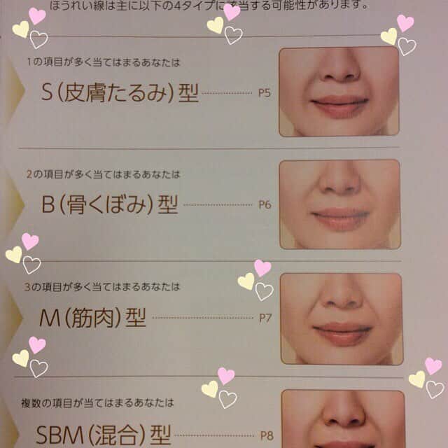 恵比寿フィラークリニックさんのインスタグラム写真 - (恵比寿フィラークリニックInstagram)「😉ほうれい線タイプ😉気になるほうれい線😭実際より老けて見える原因です💦#あなたはどのタイプ #ボトックス #ダウンタイムなし #プチ整形 #シワなし #アンチエイジング#若返り #やみつき #恵比寿美容 #注入」11月23日 15時43分 - filler_clinic