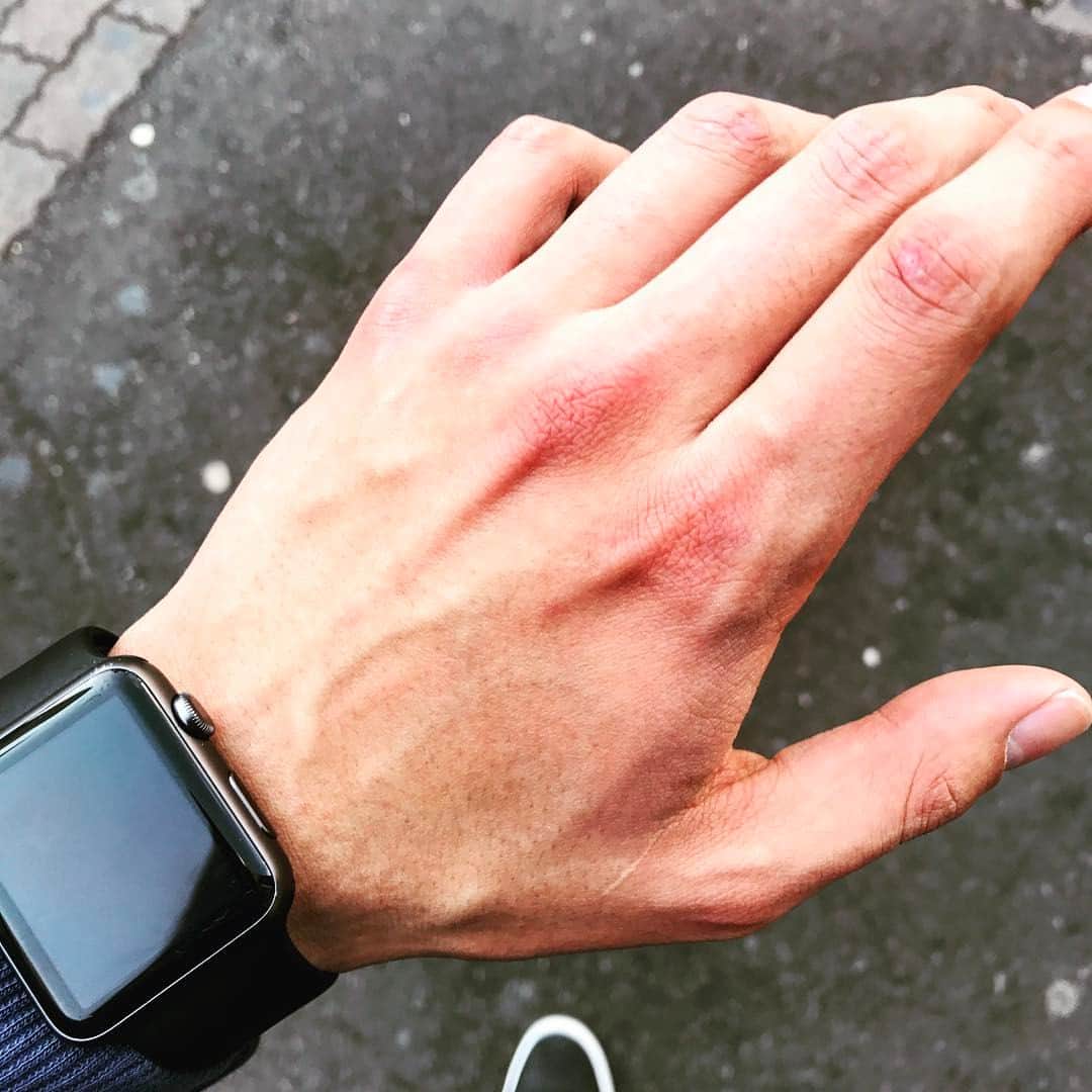 長田成哉のインスタグラム：「足の指の爪チョイめくれしちゃったし、左手も痛いから、明日休めよう。」
