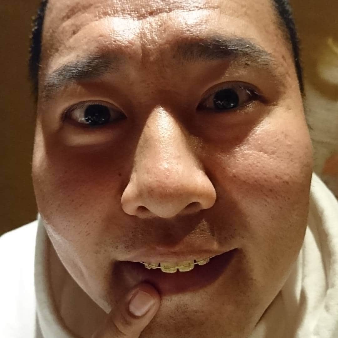 松本康太さんのインスタグラム写真 - (松本康太Instagram)「安心してください♪はめてます♪(^.^)とにかく明るい安村くんが歯の矯正を今日から初めました♪  #とにかく明るい安村 くん#歯 #歯の矯正 #歯医者 さん#よしもと #後輩 #安心してください#裸 #芸人」4月14日 0時29分 - aruarutankentai.matsumoto