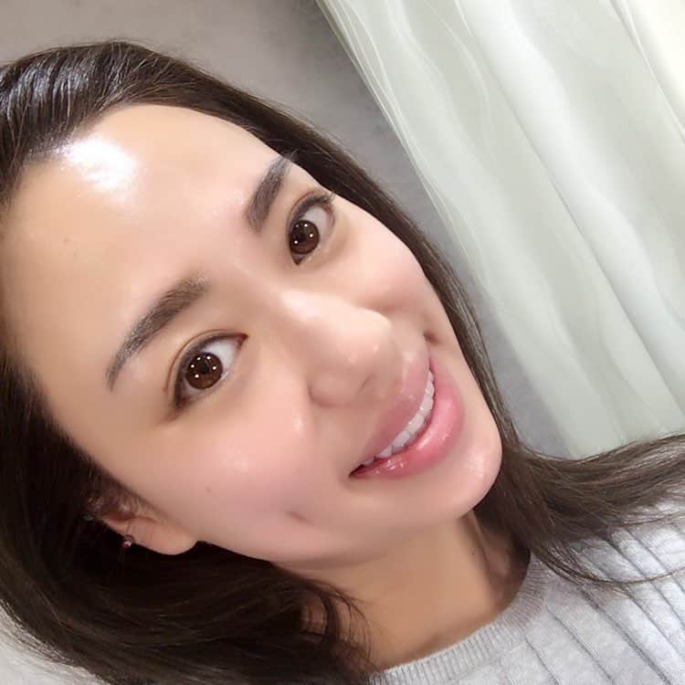 中谷紋菜のインスタグラム：「#エスビューティークリニック にて#お肌のお手入れ ✨#リフトアップ に#アクセントウルトラv !!#レーザートーニング の#レブライトsi で#シミ#くすみ#撃退 !! 最近肌に#透明感 が出てきて、お手入れもしやすく、化粧水もぐんぐん入るからとっても嬉しい😆✨ まだまだ通います💪💪 #sbeautyclinic #sbeauty #clinic#渋谷#道玄坂#美容皮膚科#アンチエイジング#始めてます#シミ#シワ#いらない#美肌#もち肌#艶肌#目指してます#顔には#日焼け止め#必須 !! @dr.y.yumi &#クリニックの皆さん#いつもありがとうございます 🙏✨#これからもよろしくお願いします 💚💚」