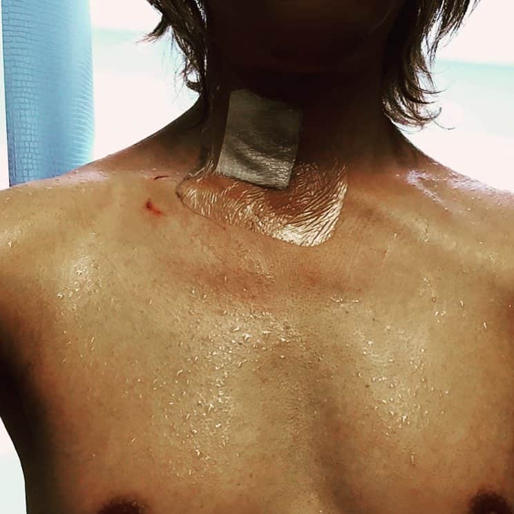 YOSHIKIさんのインスタグラム写真 - (YOSHIKIInstagram)「Neck surgery..and still in pain, but I'll rise from the ashes.手術後。。まだ痛い、でもまた這い上がる #WeAreX  https://www.instagram.com/yoshikiofficial/」6月1日 20時49分 - yoshikiofficial