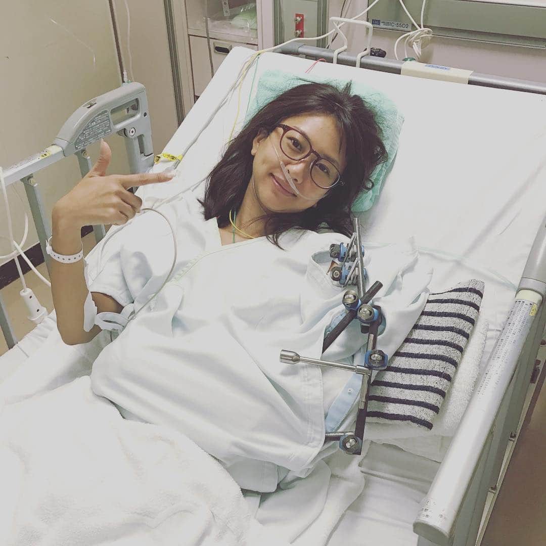 澤田南さんのインスタグラム写真 - (澤田南Instagram)「23日の夜中に自宅のロフトから落ちて入院なうです。 突然のことでびっくりさせてしまいすみません… 肘と腕を計3ヶ所、粉砕骨折してしまいました。 結構ひどい骨折のようで、救急車で運ばれてすぐに緊急手術になり、さらに翌日また6時間かけてプレートをいれる再手術をしました。 特にお仕事関係の皆様には、 ご迷惑ご心配お掛けしてしまい大変申し訳ございません。 毎日痛みとの戦いで、初めての入院やギブス生活は不自由なことも多く、当たり前のようにできていたことのありがたみを痛感する日々です。 ですが、わたしは元気です😊✨ リハビリ含めて時間はかかるかもしれませんが、焦らず、でも一日でも早く復帰できるように頑張ります‼️」8月27日 9時47分 - sawada_minami