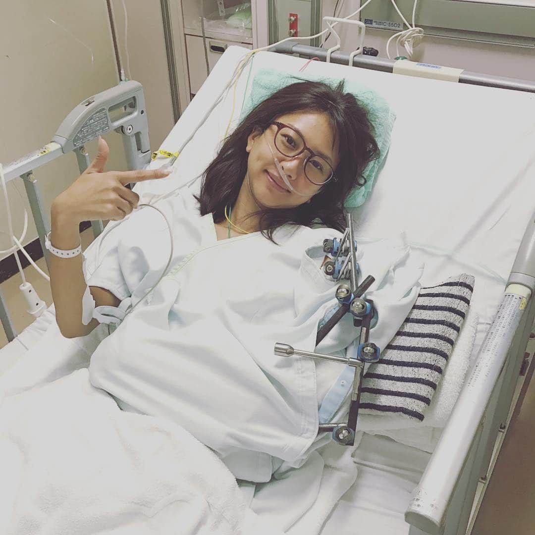 澤田南のインスタグラム：「23日の夜中に自宅のロフトから落ちて入院なうです。 突然のことでびっくりさせてしまいすみません… 肘と腕を計3ヶ所、粉砕骨折してしまいました。 結構ひどい骨折のようで、救急車で運ばれてすぐに緊急手術になり、さらに翌日また6時間かけてプレートをいれる再手術をしました。 特にお仕事関係の皆様には、 ご迷惑ご心配お掛けしてしまい大変申し訳ございません。 毎日痛みとの戦いで、初めての入院やギブス生活は不自由なことも多く、当たり前のようにできていたことのありがたみを痛感する日々です。 ですが、わたしは元気です😊✨ リハビリ含めて時間はかかるかもしれませんが、焦らず、でも一日でも早く復帰できるように頑張ります‼️」