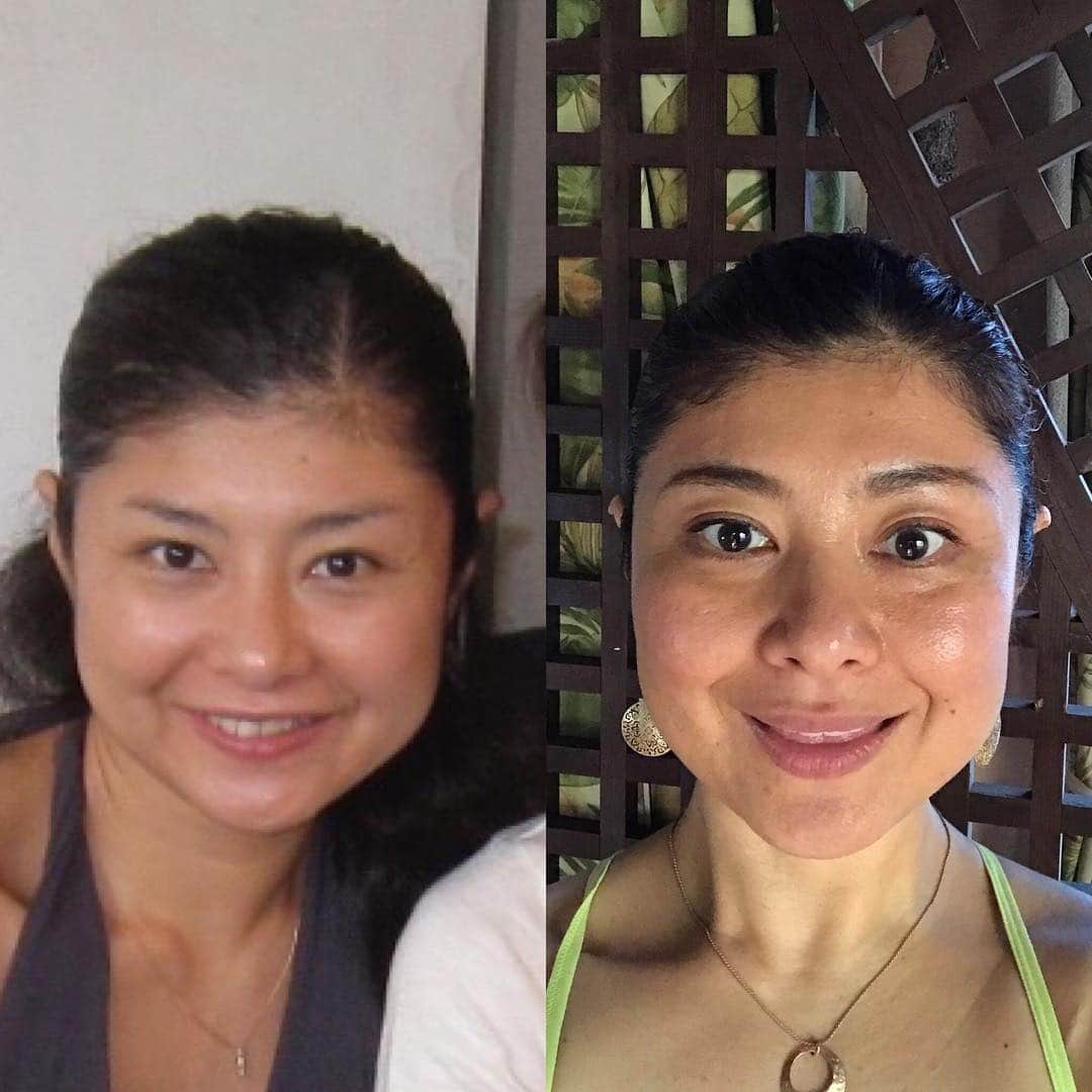 間々田佳子のインスタグラム：「顔の癖を直すとこう変わる😊✨ 2010と2017 体重差5キロ 前の方が痩せてる…  これから5キロ痩せたらどうなるかしらと ダイエットはしてみるものの…痩せない…  どうして？ なぜ？  #間々田佳子 #顔ヨガ #顔ヨガビフォーアフター  #facialfitness #fitnessfacial #gymfacial #facialyoga」