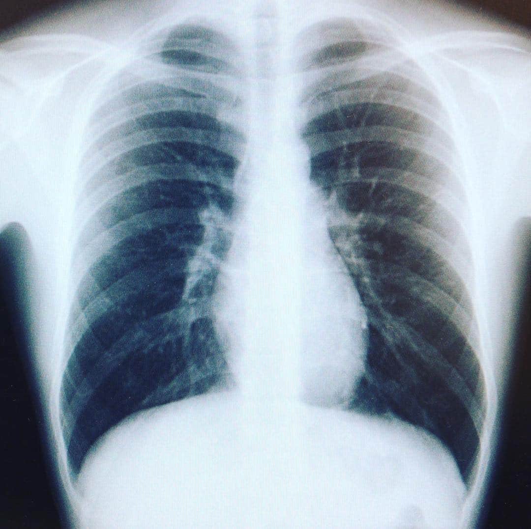荒木次元のインスタグラム：「レントゲン撮りがち #xray #skeleton」