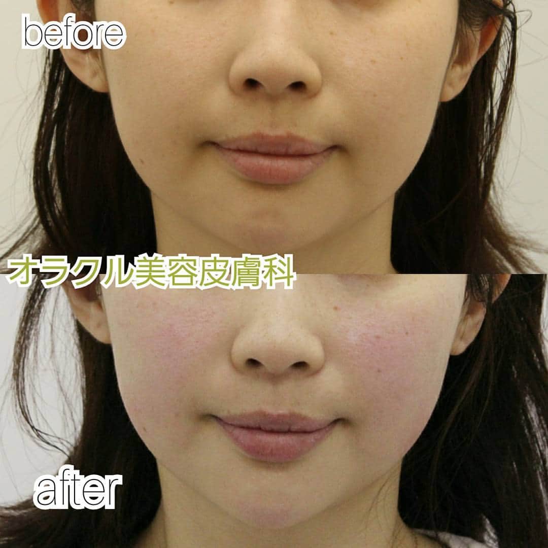 オラクル美容皮膚科東京新宿院のインスタグラム