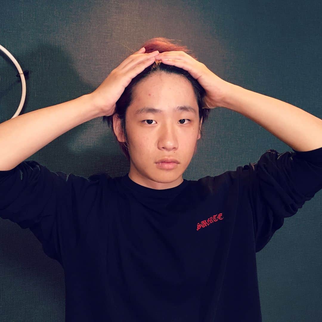のインスタグラム：「デコにニキビが出来た記念に、パシャリ。 #記録 #後世に残すべきもの」