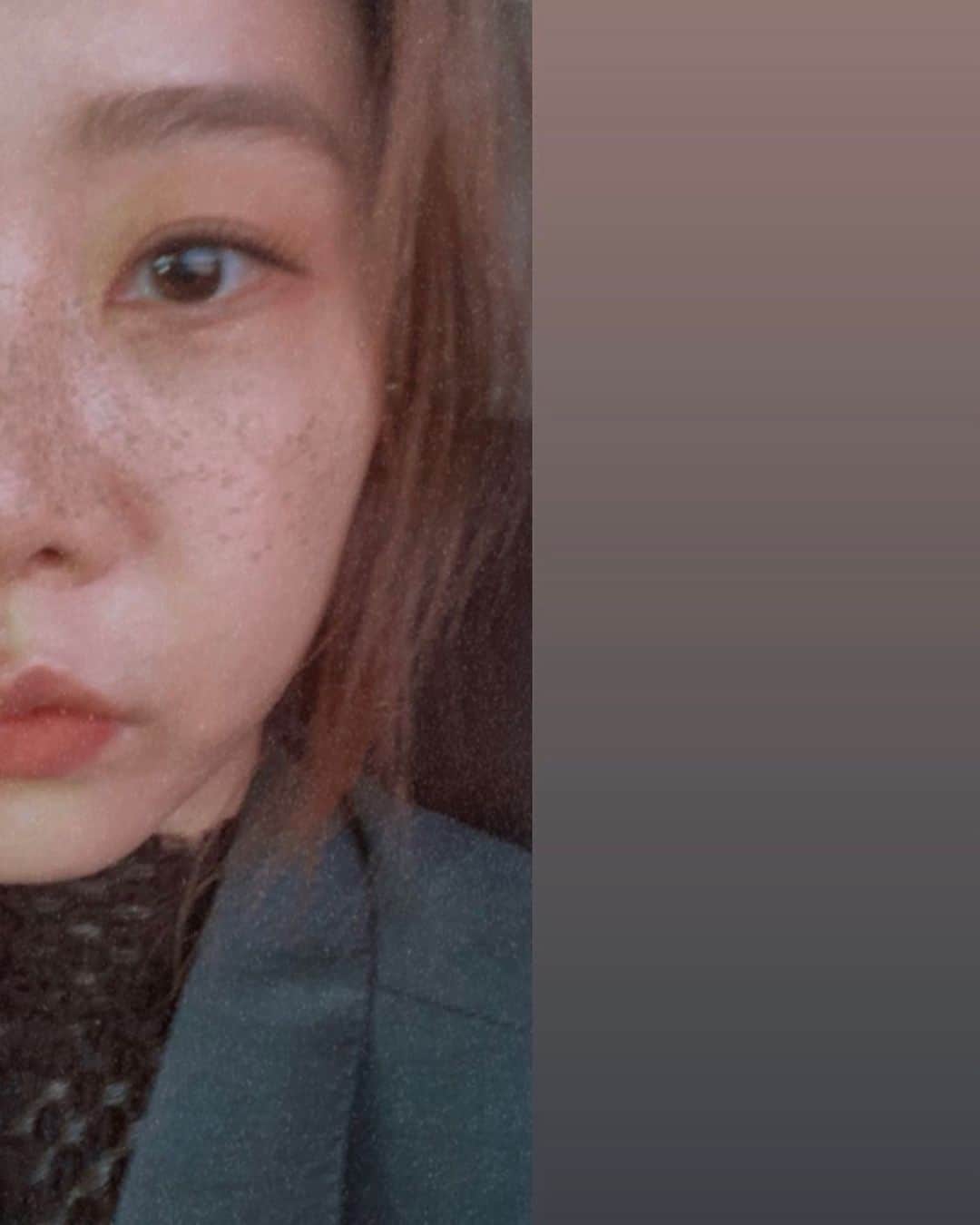 ソジン のインスタグラム：「Freckles😶」