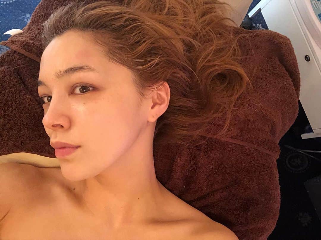 のインスタグラム：「💆‍♀️✨ 2月末に行ってきたエステ、気持ちよかったなぁ… パワーツリーにフェイシャルでスッキリさせて 頂きました☺︎ 加工をしていないのでおでこが赤いですが、 金の糸で産毛などの脱毛をしてもらったからだよ！ チクチクはするけど耐えられる痛みです☺︎ 身体の相談もしながらケアしてくれる  @aione_0123 さん。 ありがとうございました！ また落ち着いたら、行きたいなぁ… #love #skincare #bodymake #痩身 #エステ」