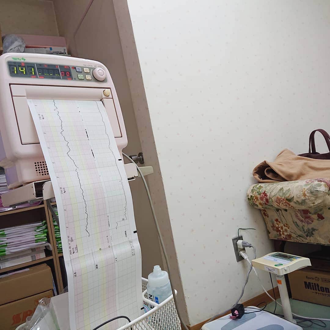 和泉杏さんのインスタグラム写真 - (和泉杏Instagram)「♡ 皆さん、いつも一緒にちゃんちゃんちゃんの誕生を待っててくれてありがとうございます♡ . ブログにも書いたんですが… 日付は変わって昨日は、 週に一回の妊婦検診に行ってきました！ . 1枚目は、 2度目のＮＳＴ（ノンストレステスト） . . 検診では… 先生『陣痛こないの？んー、困ったねぇ』 私の心の声（えっ、でもまだ1日しか…） * * そして内診後… 先生『んー、これならなんとか産ませられるか…』 心の声（う、馬、馬、産ませられる！？！？とは！？） * * そして衝撃の言葉… 先生『日曜日の夕方入院して、月曜日に産みましょう』 心の声（う、海、膿、産みましょう！？！？！？ えっっっ！？！？） * * そーゆーのって、 予定日を1週間とか過ぎても陣痛が来ない場合とかじゃないの！？ 一日超えただけで！？！？ . …もうビックリした衝撃で産まれるとこでした。。 . . そして、 子宮頚管を柔らかくする注射をして帰ると… トイレでティッシュに薄い血が！！！ 突然『おしるし』が来ました！！ . . とりあえず破水したら怖いと思って、 頂き物の破水パットをパンツに敷こうと思って広げると… 破水パットのバカデカさにもビックリ！！ ＼(✽ ﾟдﾟ ✽)／ . . ちょっと…止めどなくやってくる衝撃に もう、ちゃんちゃんちゃん一回顔出て来てたと思います！！！！ . . おしるしが来てから出産までの期間も人それぞれだから、 特に日曜の入院まで何も起こらないかもしれないし、 . もしかしたら… 月曜日を待たずして 産まれるかもしれません！！ . 遅くとも月曜には産むことが決定！（急に） . 衝撃とドキドキとワクワクとハラハラが！！ 急に全部やってきて！！！ もう、キャハハー♡ . . . #妊婦検診 #予定日超過 #衝撃の発表 #産む日が決まった #おしるし #妊婦 #妊娠生活 #衝撃多い #ちゃんちゃんちゃん #ほんとにあと数日で会える #ドキドキ #二枚目の写真 #私に似てる気がする #菊田家 #菊田夫妻 #菊田夫婦 #ハナコ菊田 #ハルカラきょう」4月18日 1時49分 - izumikyou