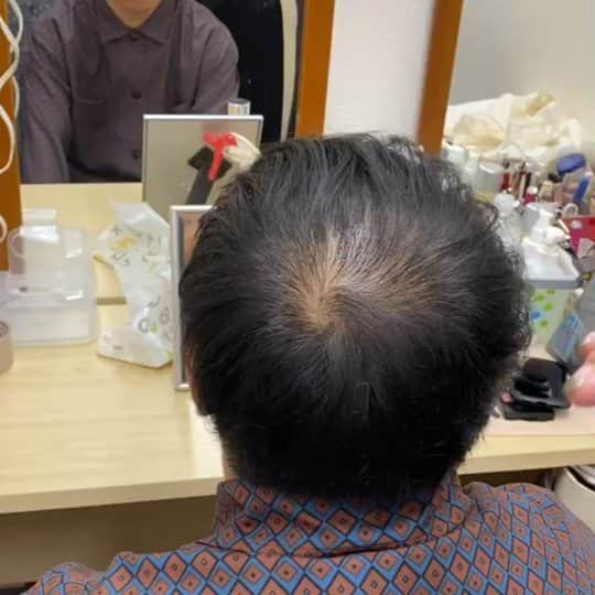 守谷日和のインスタグラム：「. なんだよこんなのあるのかよ！ 消える消える！ この動画３０秒くらいあるが最後まで見て。 違いがはっきり分かる。  #おハゲが消える動画 #けっこう前の動画だからね」