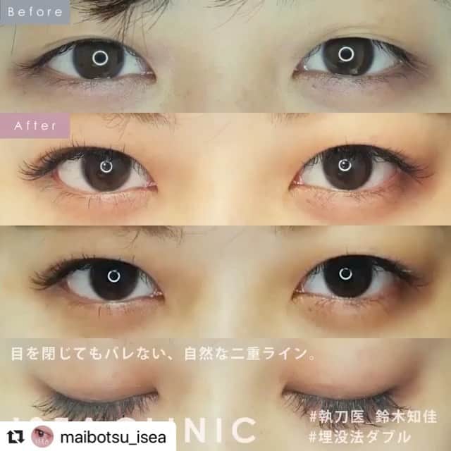 東京イセアクリニックのインスタグラム