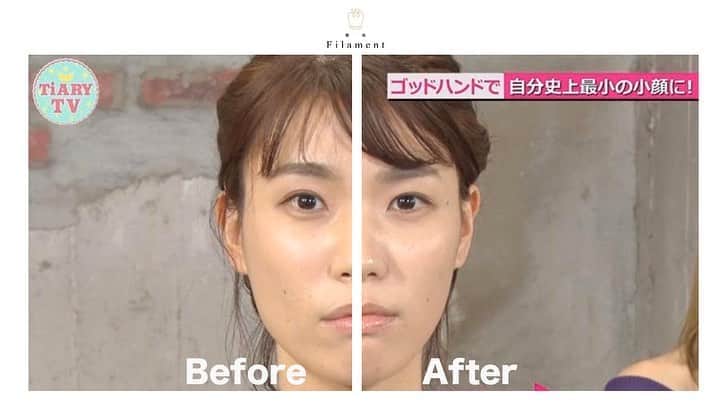 美容整体師川島さん。のインスタグラム：「【ご報告🗣】 実は、２ヶ月ぐらい前から 川島式小顔矯正の手技を研究に研究を重ね、 新しく改良し、その技術が完成しました！ . これが先日関東で放送された、 新 川島式小顔矯正のビフォーアフターです。 (2月収録済み) . 明日香キララさんや紺野ぶるまさんが出演する番組に 出演させていただいたんですが、 その時に写真でいう右側を施術しました。 . 今回、何が変わったかと言いますと 以前の技術は、 . 皮膚→皮下脂肪→筋肉 に対するアプローチだったんですが、 . 新 川島式小顔矯正 皮膚→皮下脂肪→筋肉→骨膜 というさらに１段回、深い層に アプローチする技術に変わり、 変化がかなり大きくでるようになりました。 . ただ今回の手技はアプローチする場所が１つ深い層に なったので、さらに解剖知識が必要になり、 SNSで簡単に発信することが厳しくなりそうです。 . ただ、このご時世なので整体に行けない人も多いと思い 急ですが、本日２１時〜より 『自宅でセルフ 新 川島式整体 LIVE配信』を 配信することにきまりました。 ※2回目の配信はしない予定です。 . ただ今回は、 KOUと美容塾のメンバーだけにさせてもらいます。 詳しくは、プロフィール欄のリンクを見てください。 . -美容整体師 川島悠希 . #川島悠希 #整体Filament #整体 #小顔 #マッサージ #トレーニング #運動 #自宅」