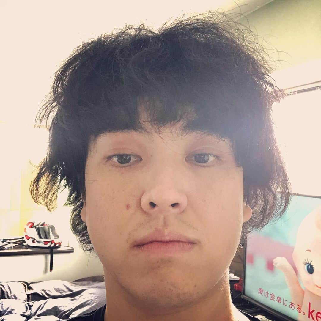 藤田崇之のインスタグラム：「親知らずを右側上下2本抜いてきました！ #親知らず抜歯 #1時間経過 #寝てる間に終了 #今のところ無痛 #夜に痛くなるかもらしい #本当に腫れるのか？」