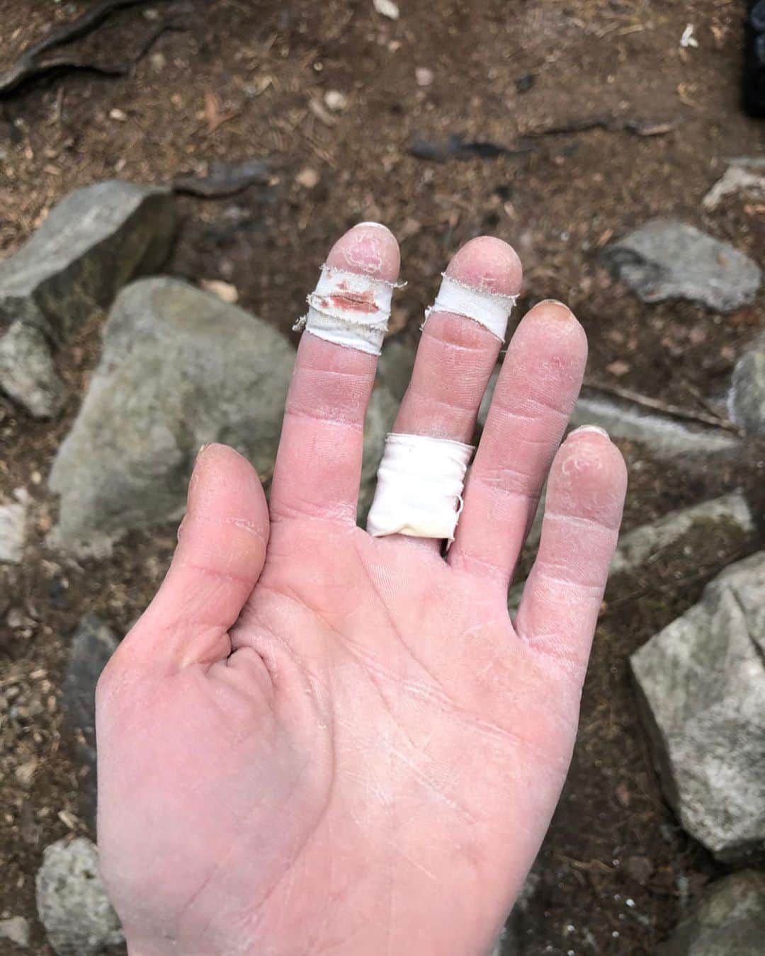 マチルダ・セーデルルンドさんのインスタグラム写真 - (マチルダ・セーデルルンドInstagram)「Some of the key features of the battle with Armstrong assis (8B); two finger crimping on crystals, falling off the last move (6 times!), contemplating on how many more tries I can give before my skin is completely wrecked, lots of tape, splits... 😆  On a more serious note. This month I was supposed to be in Switzerland for my first project and goal of the year. Obviously I’m still in Stockholm and we’ve been able to keep climbing outside here. Before this season I had bouldered outside a handful of times (but I do it a lot in my training indoors ofc). It’s been super rewarding to discover the bouldering in my home area and also to experience the process of a bouldering project (quite different from sport climbing I would say). Armstrong assis took me 9 sessions in total, I fell on the last move so many times I started doubting that I was capable of sending it haha - then, with taper up skin and splits on 4 fingers, it suddenly happened. So happy 🤩 Hopefully a little video is coming soon!  Thanks to my coach @melissaleneve for your dedication and psyche, it’s so cool to be able to share this process with you! Can’t wait for what’s next!  Stay safe everyone 🤍」5月2日 0時13分 - matilda_soderlund