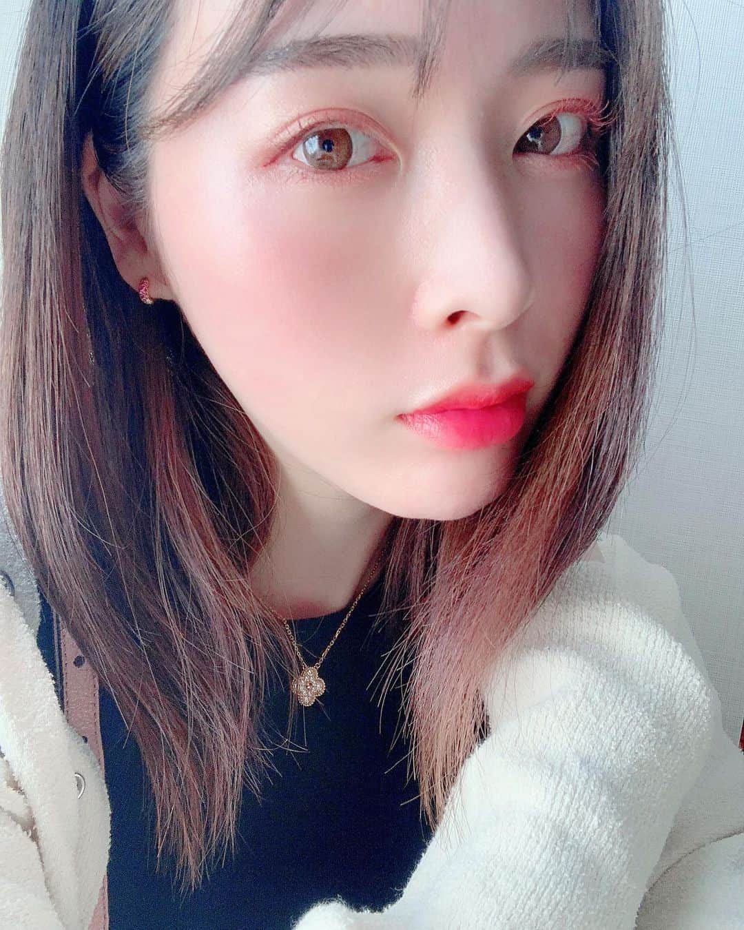 本田岬のインスタグラム：「緊急事態宣言が出る前に、どうせ引きこもるなら美肌治療しよう！と思ってプルージュクリニックさんでぷるぷるフェイスを受けてきました⸜❤︎⸝‍ ぷるぷるフェイスとはダーマペン4を行いその後に自分の血液から抽出した成長因子（PRP）をお肌に浸透させていくというもの..🥰 ダーマペン4で肌に細かい穴を開けていくから成長因子がお肌に浸透しやすくなるよ✨ ダウンタイムは1週間くらいで内出血になります！私は3日後くらいからぽろぽろと細かい皮向けがしてきたよ🤟 個人差はあるけど内出血が完全に無くなったのは私は丁度1週間でした(๑•̀ •́)و✧ ぷるぷるフェイスは麻酔クリームを塗ってから行います！ わりと痛いけどこれで綺麗になるんだ！と耐えました🤣 針の深さは選べるので痛みに弱い人でも安心だよ✨ 赤みが出るからマスクと帽子を持っていくのがおすすめ✌️ お陰様でお肌ぷるぷるツルツルになったよー💓 ぷるぷるフェイスは初めてだったのでどきどきだったけど先生や看護師さん受付スタッフさん皆さん優しくて安心して受けることが出来ました⸜❤︎⸝‍ プルージュクリニックさんありがとうございました( ⁎ᵕᴗᵕ⁎ )  @pruge_clinic  #プルージュクリニック #プルージュ美容クリニック #ぷるぷるフェイス #ダーマペン4 #ダーマペン #prp #成長因子 #美容 #美肌 #美肌活 #肌再生 #肌改善 #美活 #美肌治療 #美容クリニック」
