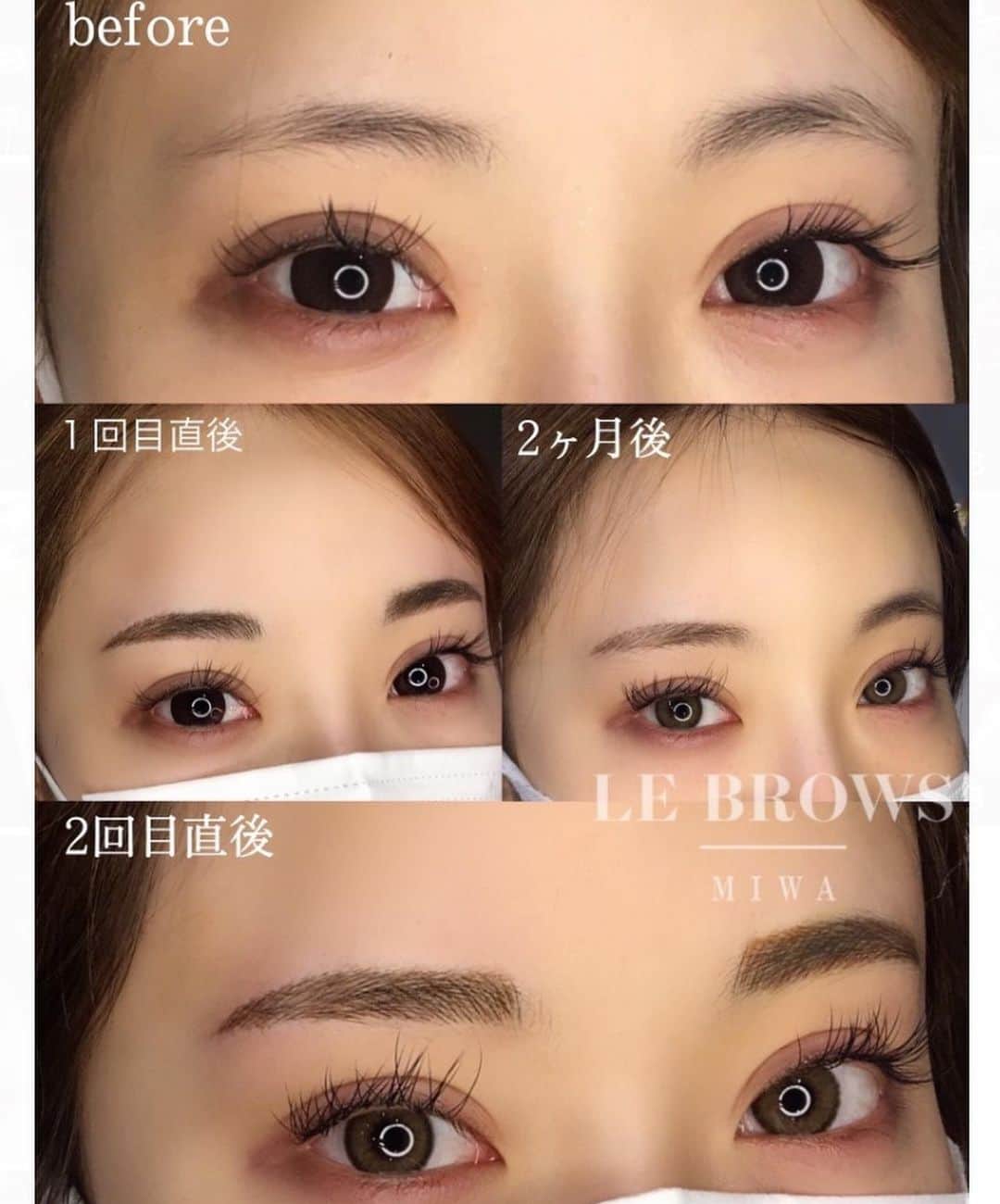 黒宮ちはやさんのインスタグラム写真 - (黒宮ちはやInstagram)「@elena__clinic の @lebrows_tokyo で 眉アート2回目してきたよん( ¯•ω•¯ )❤️ 担当者さん @miwa_lebrows . 2枚目にbefore~全部載ってます！ 光が眩しくて目が全然開いてないの恥ずかしいw . 黄金比を測ってもらいながら バランス悪くならない程度に 今回は目尻を少し長めに 入れてもらいました🎵✨ . 2回目入れることで 色、形もしっかり定着してくるみたい🐥 今回も仕上がり最高すぎる(⸝ᵕᴗᵕ⸝⸝)❤️ . まじで眉アートは男女みんなやった方がいいと思うよ 本気で勧めれる  #エレナクリニック #アートメイク眉 #アートメイク」5月3日 14時40分 - chihaya_kuromiya