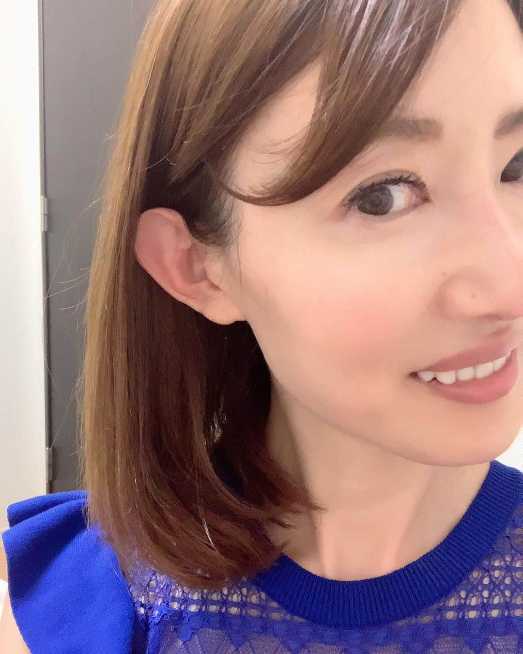 渋谷恭子さんのインスタグラム写真 - (渋谷恭子Instagram)「いつもお世話になってる、東京中央美容外科大宮院 @tcb_omiya で、原田先生 @dr.harada_hiromitsu に目尻のボトックス注射の施術をして頂いてから2週間が経ちました😊 ・ ・ 1週間後くらいから、ジワジワと効果が出てきて、今は思いっきり笑ってもくっきりしたシワも小ジワもかなり目立たなくなりました！ ・ ・  やり過ぎ感なく自然な仕上がり！ その辺のさじ加減がとっても上手な原田先生✨ ある程度までお伝えして、後はいつもお任せしてます。 何か気になることがあったら、お気軽にご相談してみてくださいね😉 私のインスタ見たとお伝えすると良いことあるそうです💕 ・ ・ #美容整形ならTCB東京中央美容外科 #東京中央美容外科 #美容外科 #大宮 #東京中央美容外科大宮院 #原田浩光 #PR #プチ整形 #ボトックス #ボトックス注射」5月4日 11時31分 - kyoko.86