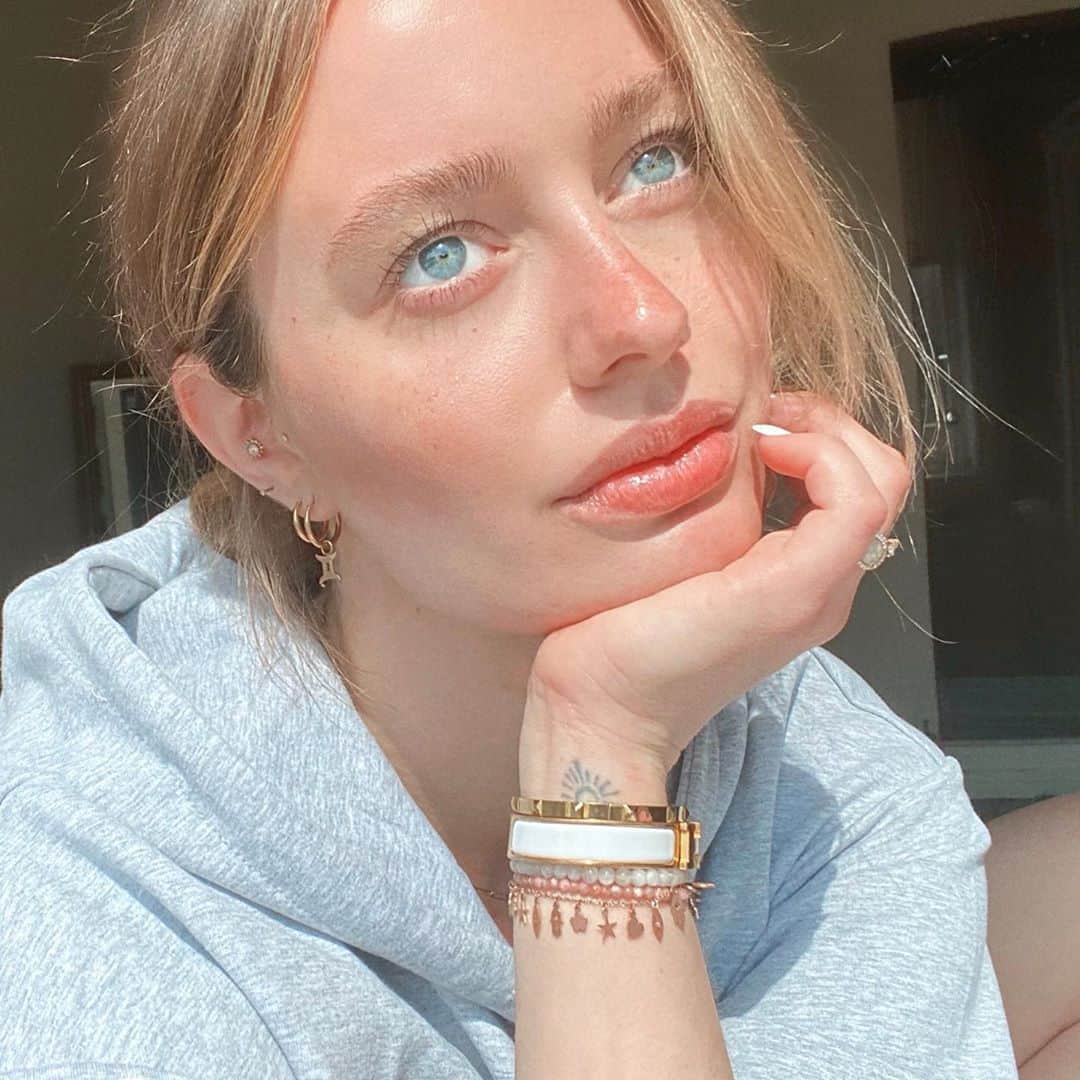 SONYA ESMANのインスタグラム：「asking the sun why it gave me a sunburn when I asked for a tan. such is life. 🕊」