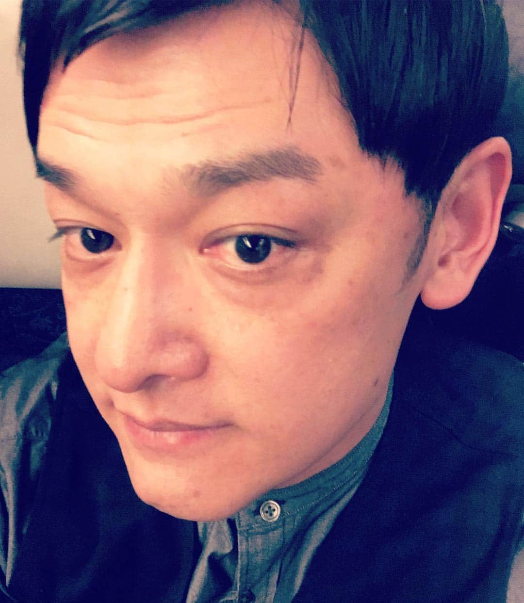 宮田麺児のインスタグラム：「ご報告。 ゴリラクリニックにて完全にヒゲがなくなりました。  #ゴリラクリニック#ヒゲ#脱毛#つるつる#ライチ#青い肌が肌色に#てつじ」