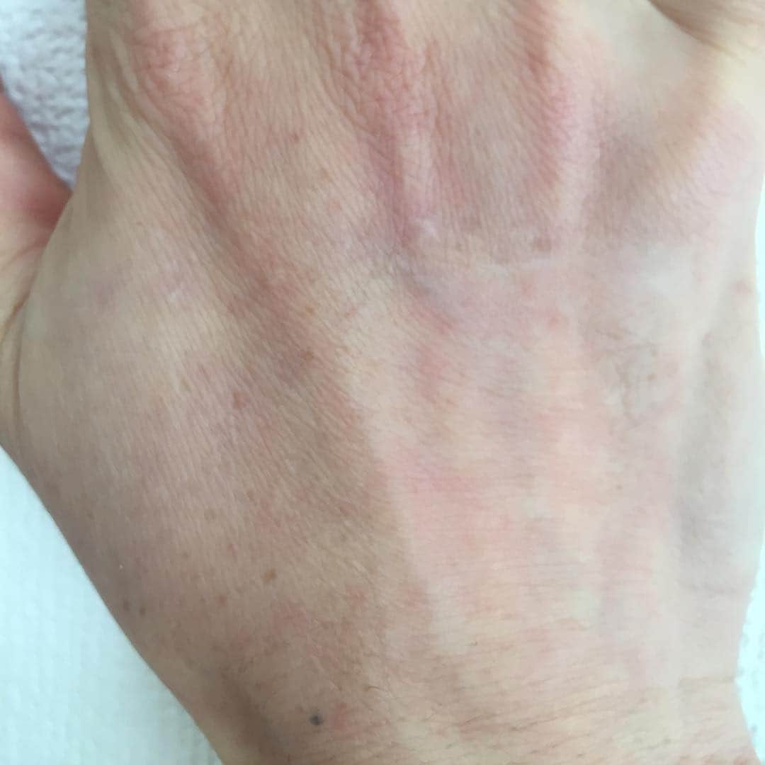 間々田佳子のインスタグラム：「シワ取りテープで手のシワもこの通り👌💪 ほんの30分貼っただけ…😊 #間々田佳子 #顔筋しわテープ  #顔筋シワテープ  #グッズマン #顔ヨガ」
