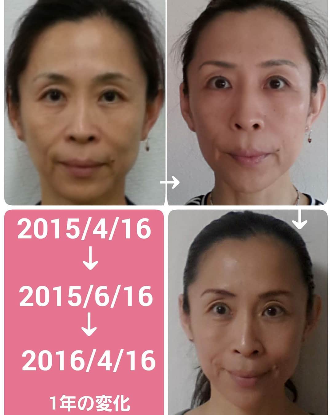 間々田佳子のインスタグラム：「#顔ヨガビフォーアフター #顔の運動不足から元気顔に 顔も筋肉鍛えることができるんです✨😊」