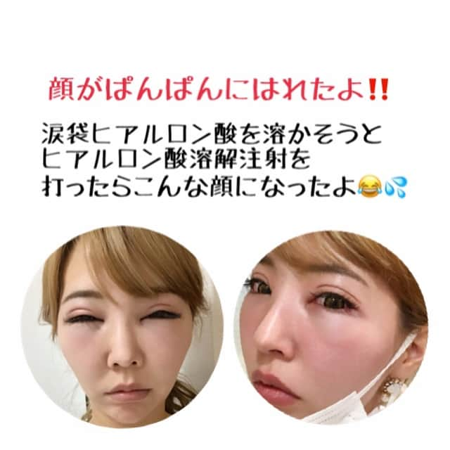 吉川ちかのインスタグラム