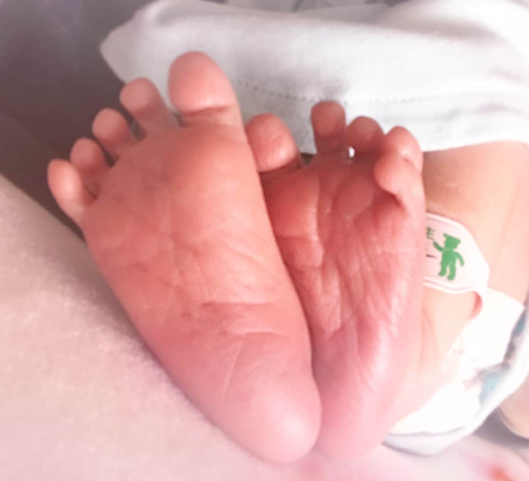 のインスタグラム：「✴︎ 次男👶🏻然くんの #和痛分娩 の#出産レポ① 忘れないうちに✏️ 長くなります。笑 ・ ・ 前postで🚽に2時間引きこもる事件。笑 その日入院になったが朝には落ち着いて一旦帰宅。 一旦帰宅してからは、前日の診察で子宮刺激されたからなのか、腰回りが重い感じがあって歩き方が明らかに軽快ではなくなってた。 ◉2月28日  朝一から検診だったので朝起きて旦那の朝ごはんとお弁当の準備していたらなんか出た感じがありトイレ行くとおしるしが‼️ テンション上がってトイレから旦那に "ねー！やばい！おしるしきたー！！！！！！！嬉しい！！！！" って叫んでました。笑 元々その日の検診次第で入院になるかもしれないから入院準備してきて下さいと言われていたので、入院する前提で朝から旦那のお義母さんに家来てもらい、武玄の面倒を頼んでたのです。旦那は仕事へ。 武玄をお義母さんに預けて 朝9:00に病院へ🏥 ・ 子宮口は1cm。 でもおしるしが来てるからと入院決定！ (心の中 よっしゃ✊🏽) ただ、子宮口固めらしいのでバルーン挿入しますとの事。初体験です。 (バルーンとは子宮口を広げる機械？風船で子宮に入れて膨らませるもの) 周りの友達でバルーン経験ある子に話聞いたりするけど、みんな痛かったと.... だからちょっとドキドキ。 一応浣腸してから 10:00 バルーン挿入。 う、うん、、痛いって言われてたから覚悟してたからなのか、思ってた以上に痛くはなかったけど、ずっとうぅ〜って力が入る感じで気持ちは悪かったかな💦中で違和感。笑 痛いって聞いてなければ痛いかも。 そのまま病室でNST装着して腰に痛みを調和する和痛注射をぶさり💉張りの様子見。 ・ そっからなんとなーく張りは感じるものの痛みはそんな感じるわけでなく、みんなに連絡取ったり、テレビ見たりと余裕はあった。 ただ、定期的に和痛注射を腰に3〜4回打たれたかな。 12:00も過ぎ、お腹空いたな〜お昼出ないかなぁ〜なんて空腹に耐えていたら 13:50  大迫さ〜ん分娩室移動します。と。 (心境 え？もう？陣痛来てないよ？) 助産師さんに"え？陣痛定期的に来てるんですか？"って聞いたら"来てるわよ〜だけど、分娩室に行くからってすぐ出産ってわけじゃないよ"と。 (え、もう陣痛来てるの！？全然痛くない！) ソワソワしながら分娩室へ移動。 ⬇︎ 続き  コメント欄へ」
