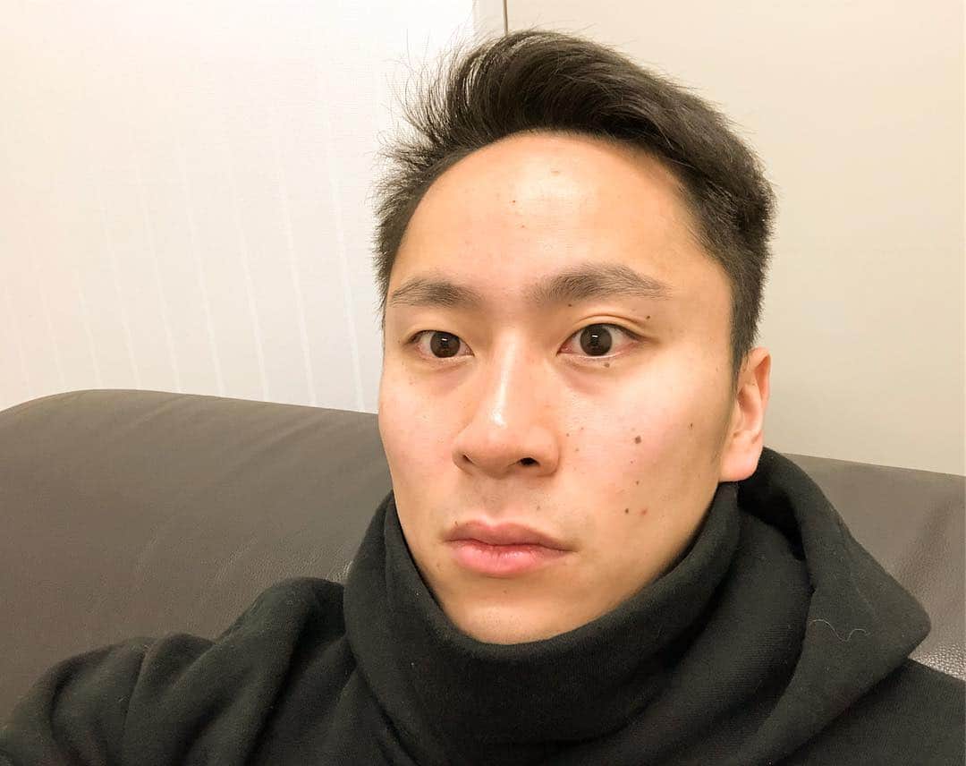 太田雄貴さんのインスタグラム写真 - (太田雄貴Instagram)「Both eyes in ICL 0.1 → 2.0 Takafumi Horie and Yukahei Sadojima of Cork CEO  had eyes surgery Lasik, so I also inspected at the same hospital, the Kobe Kanagawa clinic. There was also advice of Yoichi Ochiai, and I did it with ICL's technique called permanent contact lens.  Surgery is also 8 minutes for both eyes. I was scared, but I can say that it is the best shopping in my life.  I wanted to do it when I was an active fencer. Because contact lenses dry, I was having trouble many times.  ICL is recommended for people other than athletes. We are still satisfied because contact lenses are never thrown away around the room. Slightly expensive but cheap when thinking about quality of life.  ICLで両眼0.1→2.0 堀江 貴文 @takapon_jp さん、コルクの佐渡島 庸平 @sadycork さんがレーシックをされたので、僕も同じ病院、神戸神奈川クリニックで検査しました。落合陽一君 @ochyai のアドバイスもあり、永久コンタクトレンズとも言われるICLの術式で行いました。  手術も両眼8分。怖かったけど、人生最高の買い物だと言い切れます。  現役選手の時にやりたかった。試合中、まばたき出来ずにコンタクトレンズが乾くので困ったこと何度もあったので。  スポーツ選手以外の人もICLがオススメ。コンタクトレンズが部屋のあちこちに捨てられる事もないので、なお満足。ちょっと高いけどQOL考えたら安いッス。  #ICL #視力回復 #永久コンタクトレンズ」3月10日 11時32分 - yuki_ota_fencing