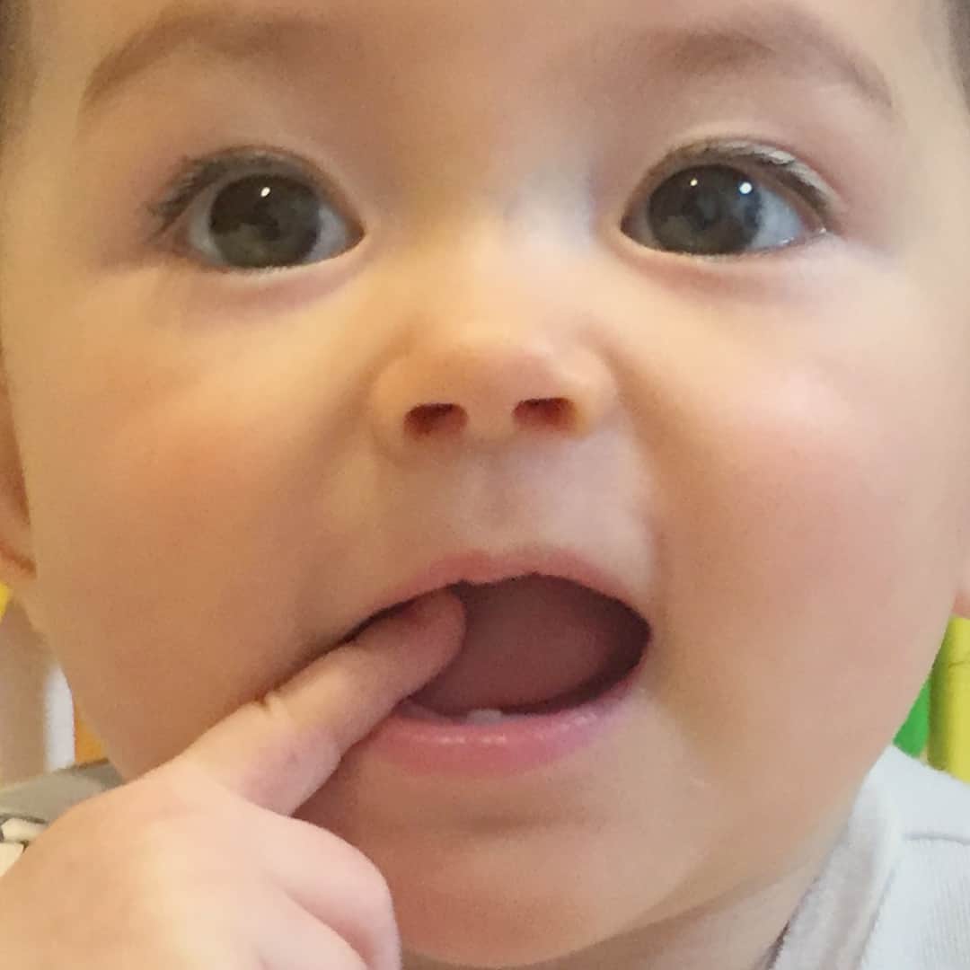 舟橋菜々さんのインスタグラム写真 - (舟橋菜々Instagram)「下の歯が一本だけニョッキリ👀💡 Check out her baby tooth! #baby#instababy#girl#kid#daughter#cute#love#happy#smile#tooth#teeth#australia#japan#mamanoko#赤ちゃん#娘#子供#8ヶ月#育児#ハーフ#オーストラリア#日本#乳歯#親バカ部#ベビフル#ママリ#コドモノ」4月9日 15時33分 - wombatnana