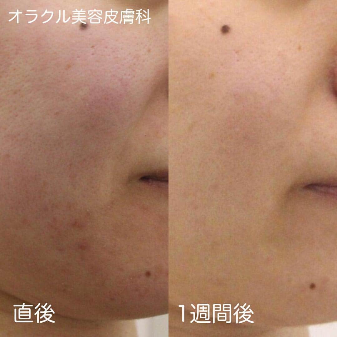 オラクル美容皮膚科東京新宿院のインスタグラム