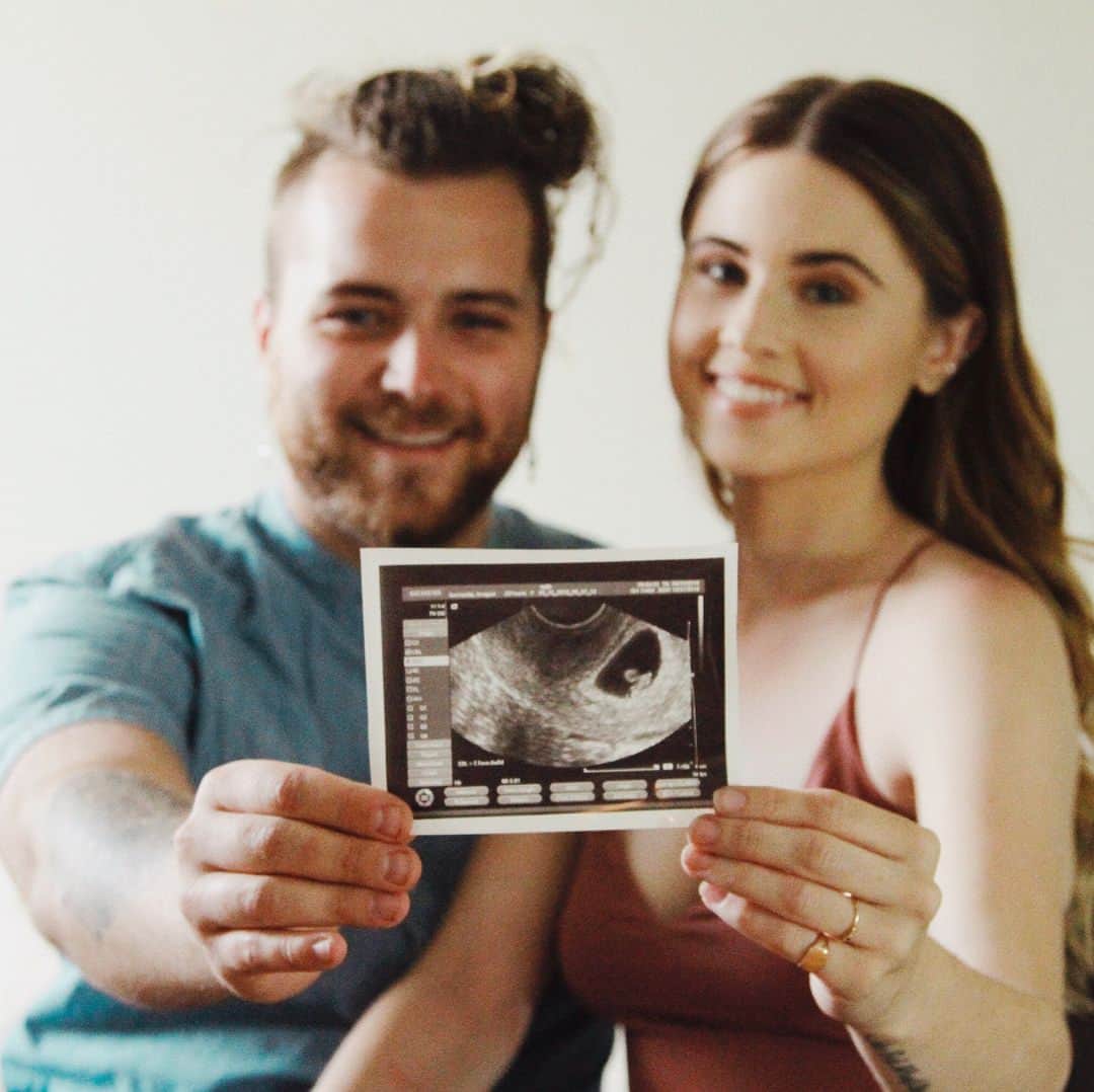 マサイアス・アンドリーのインスタグラム：「I can’t wait to meet you ❤️😘👶🏻click the link in my bio to see our announcement! I’m so excited to gain a second love of my life ❤️ photo by @starrsmith」