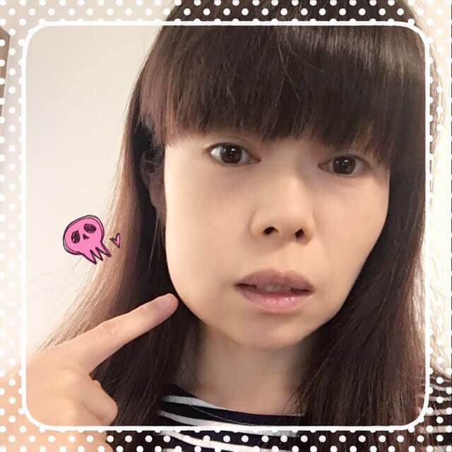 のインスタグラム：「親知らず抜いて3日目。 ・ ・ 先生から「今日が一番腫れますよ」と言われておりましたが(^_^;) ・ ・ 見事に、、、腫れておりますw すごいwww」