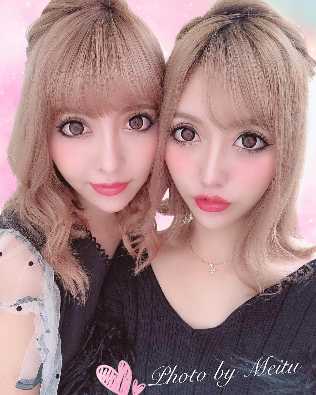 吉川ちえさんのインスタグラム写真 - (吉川ちえInstagram)「《twins🍒》 . ちかがもうすぐ鼻の手術だって👃‼️ いいなぁ～(ﾉ・_・)ﾉ 💕 . 私も鼻カウンセリング(鼻中隔延長)と目の二重幅を 狭くする修正の見積もり💰出してもらったら 310万円と言われ悩んでる😭😭💔 そのうちの250万くらいは鼻代金w . カウンセリングを受けて先生に 私の鼻は生まれつき曲がってて空気の通り道が狭くなってる💔 息しにくいでしょ？疲れやすいでしょ？と言われ確かに年中鼻詰まりだし寝ても睡眠浅いから疲れとれない🙃🙃 曲がってその空気の通り道を土台の部分になる骨なら削らないと治らないと言われたよ((((;´･ω･`)))‼️ . 手術して鼻呼吸しやすいようになって 一生悩まなくて済むって考えたらこの大金でも全然良いのかなって思う🤔💦 . ううう･･･悩む( °_° )💔 . #双子 #小悪魔ageha #整形 #鼻中隔延長 #二重幅修正」8月29日 7時59分 - yoshikawachie_16