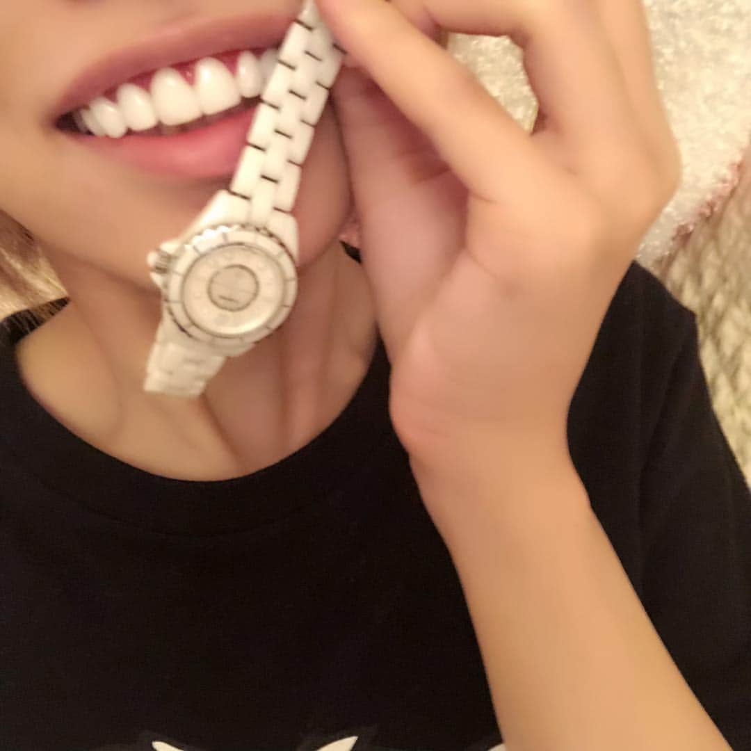 葉月七瀬のインスタグラム：「セラミック完了💋💕 白さの度合いが伝わるか分からないから同じセラミックのJ12と比較🤗 歯の方が白くない？！笑 ジルコニアで1番白いグラデの色にした💓 審美目的より虫歯治療で行ったんだけど、めちゃくちゃ先生が親身で良い人すぎた(*´oωo`*)💕 紹介してもらったんだけど紹介してくれた方と先生に感謝🙏🏻✨ . 軽く過程を、 まずカウンセリングで 次の週に歯茎ピーリングで歯茎の色をピンクにして また次の週に歯を削って歯が小さいのとガミーだったから歯肉整形で歯茎も削って仮歯になって またまた次の週仮合わせで またまたまた次の週にセラミック完了でトータル１ヶ月ちょい！ . 下の歯は親知らず抜かないとセラミックできないから時間と勇気が出たら親知らず抜いて下もセラミックする予定ではあるけど、とりあえず今現在はクリニックでのホワイトニングとホームホワイトニングで白くしていく☺️ 下唇厚おだから、そもそも下の歯見えない( ´‘ω’` ) やって良かったである💖 #セラミック #ジルコニア  #歯茎ピーリング #歯肉整形 #ガミースマイル でした #虫歯治療 #歯列矯正  #j12chanel #時計」