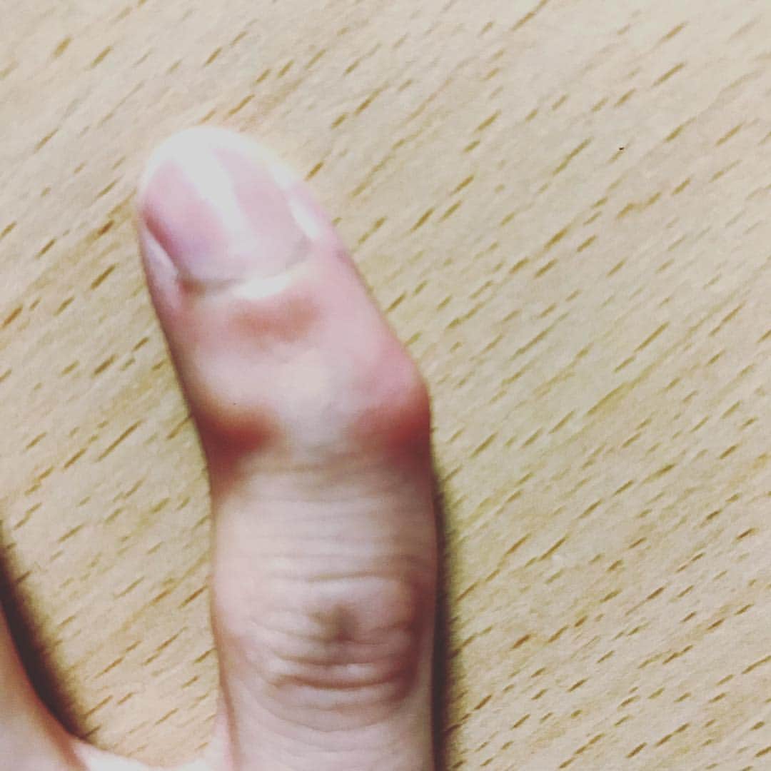 熊野直哉さんのインスタグラム写真 - (熊野直哉Instagram)「小指が曲がってるんです。  #小指」9月22日 0時27分 - naoya_akama