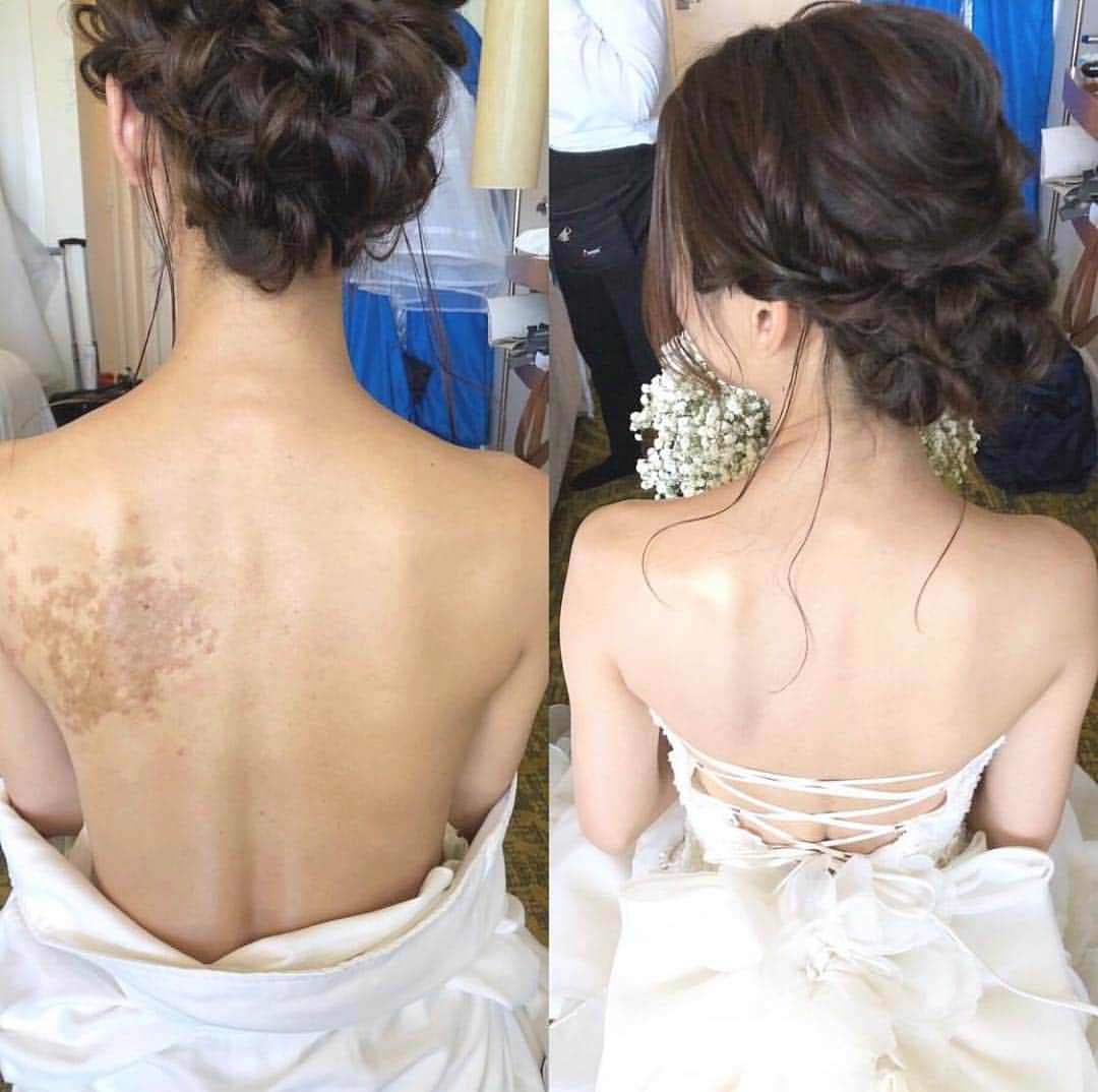 プレ花嫁の結婚式準備アプリ ウェディングニュースさんのインスタグラム写真 プレ花嫁の結婚式準備アプリ ウェディングニュースinstagram 肌にお悩みのある方も ブライダル ボディメイク でキラキラ自信を持った花嫁さんに こちらのお写真は