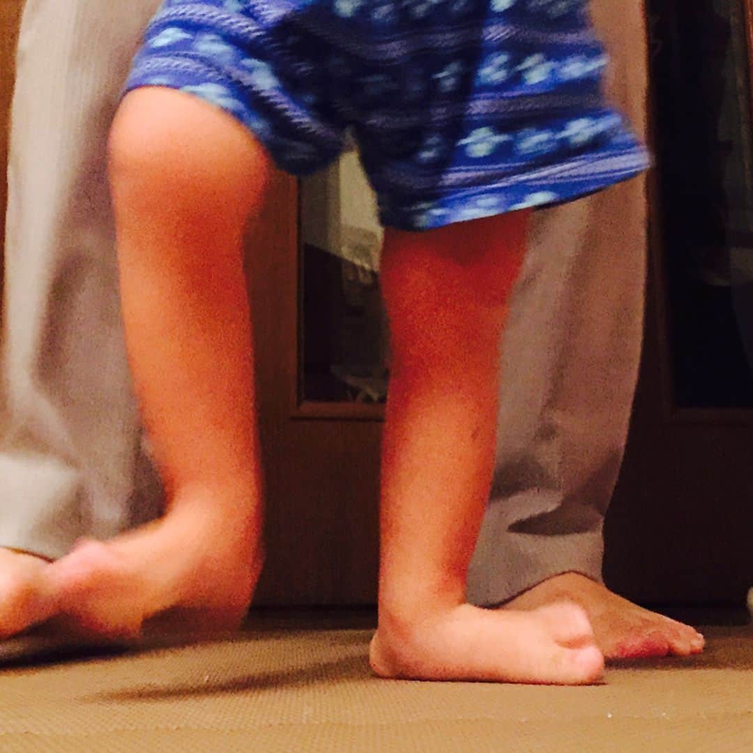龍円愛梨さんのインスタグラム写真 - (龍円愛梨Instagram)「これはニコが、伝い歩きしてるころです。ニコは低緊張が強く出ていますので、ご参考までにどうやって補助してきたかシェアしますね。  1枚目の写真は、伝い歩き始めた2歳になったころ。カカトの骨が外側にポコンと倒れて、超扁平足です。低緊張があると、こんな感じになりやすいそうです。立ってるところを真後ろから見ると分かりやすいです。  2枚目の写真は、母に持ってもらって裸足で歩いてるところです。ガニ股で、爪先が外を向いてて、扁平足すぎて小指側が浮いてしまって、足をまともに床につけてないですね。  カカトが外に出るのを防いで、土踏まずを持ち上げる補装具をつけたのが3枚目。足裏が床にしっかり着いて、爪先も前向きになって、膝も前向きに。  アメリカでは、悪い体の癖がつくから、補装具なしでむやみに立たせるなと言われました。本人が立ちたがるようになったら、補装具着けるように言われました。  4枚目は、ダウン症のある子に良いとされてるアメリカのメーカーの補装具です。カカトが外に倒れないように補強して、土踏まずを持ち上げる。それでいてプラスチックは薄くてしなやかなで足首の動きを制限しにくい。さらに母指球から爪先は自由に動くようになってることで、歩くときに爪先で床を蹴り出せるようにする。  低緊張の度合いにもよるけど、ダウン症があって低緊張かある子は歩き始めてから4-5年はこういうタイプの補装具をつけることが推奨されてます。筋力がついてきたら、靴のインソールのみで行けるようになるとのことでした。  日本だといきなり靴のインソールとするのが常識で、なかなかこのタイプの装具を作ってくれる方がいないのが残念です。でも一箇所だけ作ってくれるところを見つけました。ニコは日本に戻ってからずっとお世話になってます。  栗原補装具工房です。連絡先等はホームページでみてください。埼玉県まで行かないとならないよで、大変ですが。。 http://www.gisoku.net/kuriharahosougu/」9月22日 9時44分 - airi_ryuen