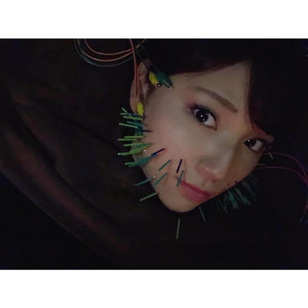 森脇亜紗紀さんのインスタグラム写真 - (森脇亜紗紀Instagram)「💆🏻‍♀️❤︎ 昨日は【 B/CARAT by koritorinic 】へ✨ いつもお願いしている @sugizakikenya 院長の美容鍼と、 今回は初めてラジオ波を体験❣️ ・ むくみや部分冷えが長年の悩みなので 初回は腕と脚の施術をお願いしました😊 ・ @b_carat.bykoritorinic のラジオ波は、 身体全体の温度を内側から上昇させて 代謝を活性化させ血流やリンパの流れを ベストな状態へ導いてくれるとの事で 施術途中からすでに身体がぽかぽか😳✨ ・ 同時にスリミングもして頂いたので、 老廃物が流れてむくみも解消されました〜嬉しい🙏🏻 腕も脚もBefore☞Afterで 全然違ってびっくり😳💓笑 冬に向けて冷えやむくみも増すので これから通いたいと思います😊 ・ ・ エステの後は美容鍼でお顔のむくみや 目の疲れをすっきり解消👀✨ 鍼の痛みは全然なくむしろ毎回その日の お顔の悩みをすぐに解消してくれるので 本当にお世話になってます☺️🙏🏻 杉崎院長、ありがとうございました✨ #bcaratbykoritorinic #きゅきゅっと美容鍼 #きゅきゅっと美顔鍼 #ラジオ波#エステ #トータルビューティーサロン」10月19日 18時49分 - asaki516