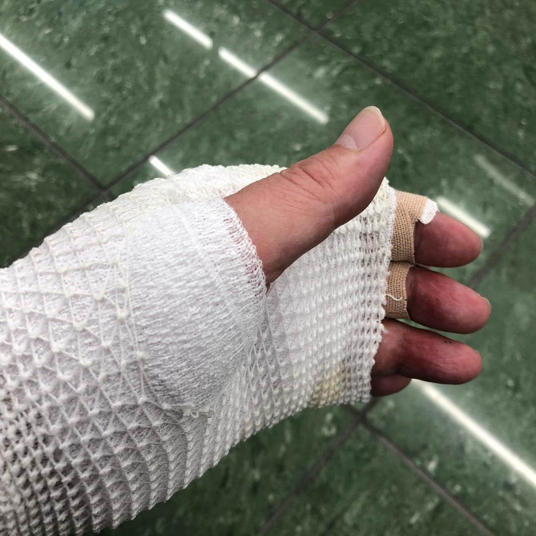 のインスタグラム：「処方待ち。やはり看護士さんが巻く包帯は美しい。 #火傷 #包帯 #ゲンタシン #フラジオマイシン硫酸塩」