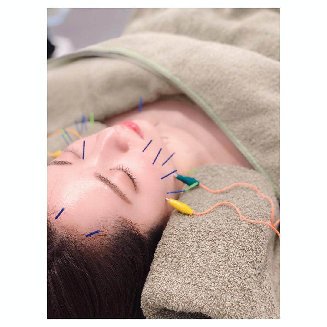 色紙千尋さんのインスタグラム写真 - (色紙千尋Instagram)「初めての鍼に行ってきましたー！！ちょっと不安でしたがとっても気持ちがよく、フェイスラインがすっきりしてひどい肩こりも軽くなりました😳✨ありがとうございました☺️🌟 #ハリッチ #美容鍼灸 #鍼灸 #美顔針」1月25日 18時04分 - shikishi_chihiro