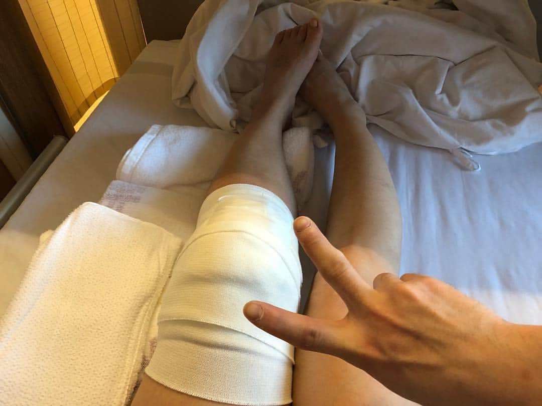 興梠友理さんのインスタグラム写真 - (興梠友理Instagram)「【術後1日目/ Day after surgery】 My knee surgery was successful! Thank you for everyone’s support!! 昨日の3月13日、無事手術が終わりました✨応援してくださった皆様、本当にありがとうございました🙏 ・ 術前の診断では不確定要素がいろいろあったのですが、結果的には ◆前十字靭帯再建 ◆後十字靭帯再建 ◆半月板縫合 ◆半月板部分切除 ←1ミリ削っただけ だけで済みました👍 ・ 受傷時は4本の靭帯が損傷・断裂していたのに、再建が2本で済むなんてありがたい‼️😆 ・ ちなみに、術前には再建が必要だろうと言われていた膝のお皿を脱臼から守る内側膝蓋大腿靭帯(MPFL)は、麻酔が効いた後にお皿の状態を確認したところ、全く脱臼する様子がなかったので再建不要となりました✨(ここまで安定していれば大丈夫という判断だったようです) ・ 手術時間は術前の麻酔と術後の覚醒も含めると5時間半くらいでした。(手術自体は3時間半くらいかな？) ・ 術後、意識が戻ってからは、足ではなく腰がとにかく痛くて(寝返りが打てないから)腰の痛みで1時間ごとに起きながら一夜を過ごしました😅 ・ ただ、術後一日目の朝からは元気そのもの‼️ 朝食はモリモリ完食。術後の発熱も微熱程度、足の痛みも局所的な痛み止め＆内服薬のおかげでほぼなし👍 もっと辛い術後一日目を想像していたので、自分も周りも拍子抜けでした😚 ・ 入院から術後1日目までずっと付き添ってくれた両親と岳ちゃんにも感謝🙏 ・ 順天堂大学医学部付属練馬病院に入院しているので、お時間のある方は是非遊びに来てくださいwww (メッセージお待ちしています❤️) ・ #努力は絶対裏切らない #ろぎ子の復活までの記録 #膝脱臼 #複合靭帯損傷 #前十字靭帯断裂 (ACL) #後十字靭帯断裂 (PCL) #内側側副靱帯断裂 (MCL) #内側膝蓋大腿靭帯断裂 (MPFL)  #前十字靭帯再建 #後十字靭帯再建 #半月板縫合 #半月板部分切除 #nevergiveup #roadtorecovery #kneeinjury #kneeinjuryrecovery #kneeinjuryrehab #multipleligamenttears #aclrecovery」3月14日 19時20分 - yuri_rogi