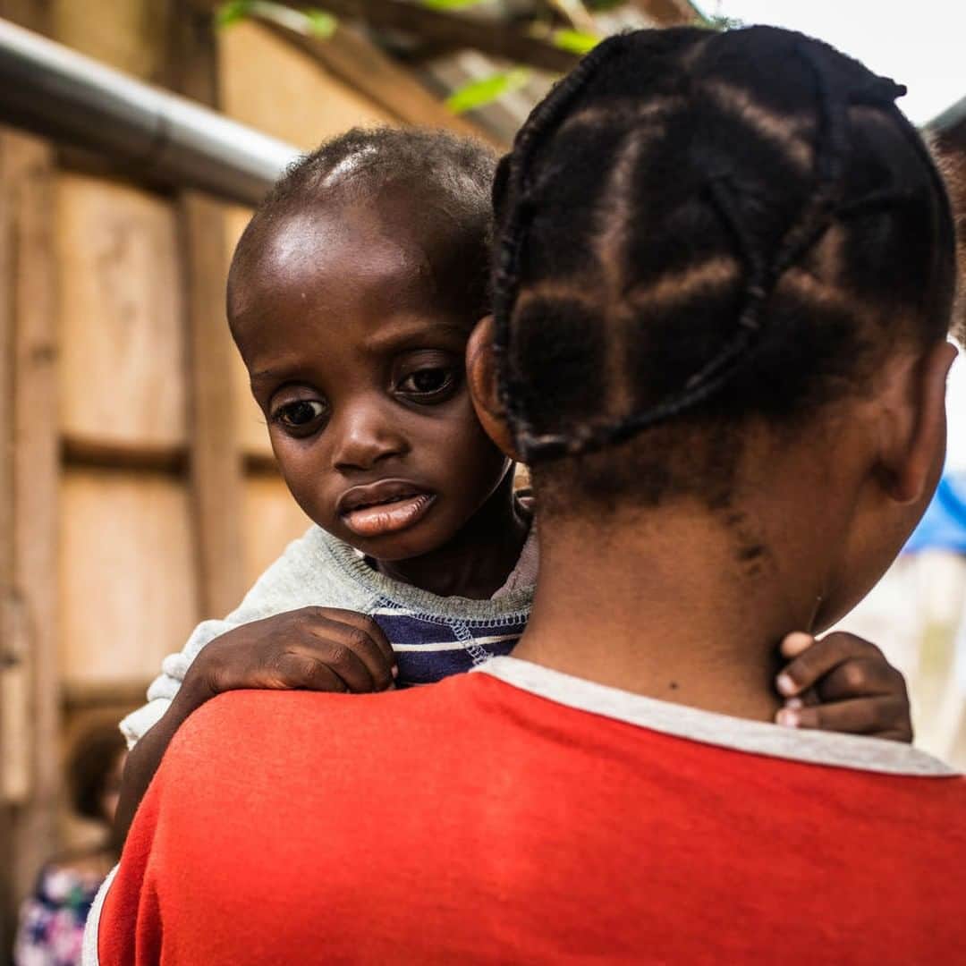 unicefさんのインスタグラム写真 - (unicefInstagram)「"My other child was sick, but it was impossible to get treatment. He died on the road. I will keep on fighting so that I can continue to feed my [only living] child." Mbombo trekked with her family for five days to safety after a militia attacked her village  in Kasai, DR Congo. She's lovingly holding Patience, her two-year-old son, who is receiving urgent treatment for malnutrition at a UNICEF-supported health centre. @unicefrdcongo is helping thousands of children like Patience recover from malnutrition in Kasai. Children cannot wait for peace. They need it now. #ChildrenUnderAttack © UNICEF/UN0271294/Tremeau」3月14日 21時55分 - unicef