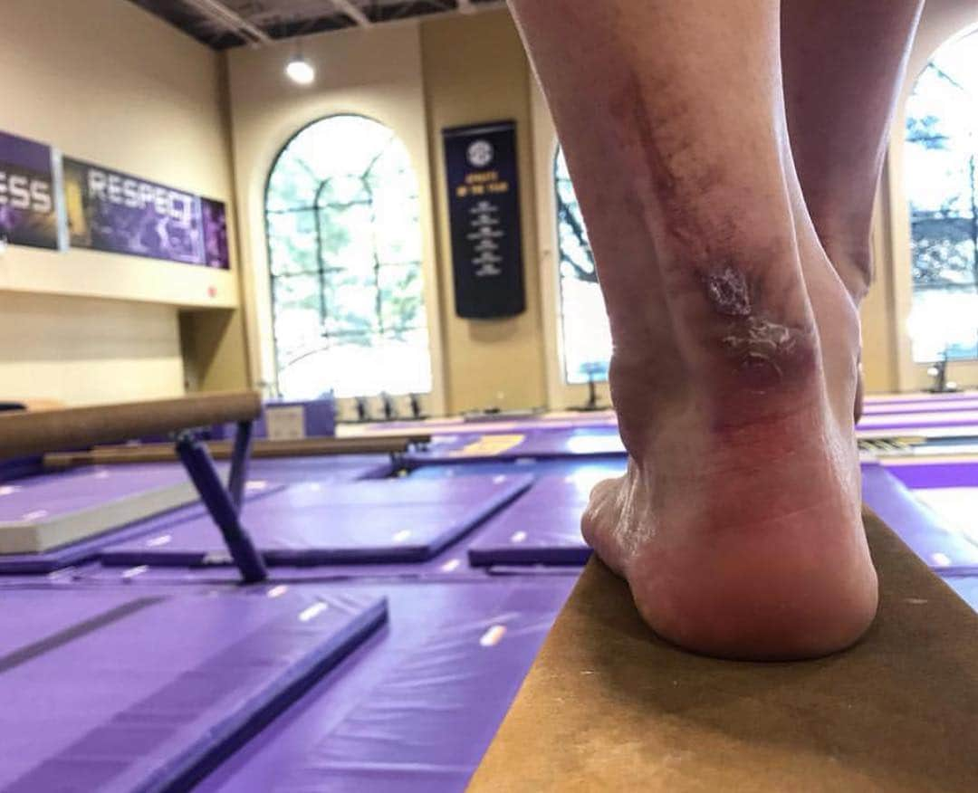 サマンサ・ペスゼックさんのインスタグラム写真 - (サマンサ・ペスゼックInstagram)「On the newest episode of the I Have Cool Friends Podcast, @mckennkelley discusses the worst parts about being a gymnast: injuries & fears... annnd how she grew through those experiences to be a better athlete, better leader, & a better person. She got redemption from her Achilles tear this past weekend when she scored a PERFECT 10 on senior night. She even shares her thoughts on taking a 5th year. Oh yeah & we talk about how everyone introduces her by using her mom’s name first & her thoughts on it. • She’s the hype man on her team & if you’re looking for some inspiration, she can be a hype man for you too... but I called her first 🤪 #IHaveCoolFriends」3月15日 1時20分 - samanthapeszek