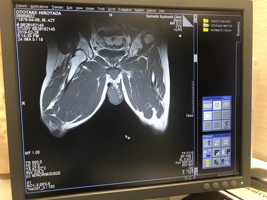 乙武洋匡さんのインスタグラム写真 - (乙武洋匡Instagram)「#義足プロジェクト のメンバーが「乙武さんの身体がどうなっているのか、もっと科学的に知りたい」とのことで、MRIを撮ってきました。  近々、この画像を専門家の先生に見ていただく予定です！  #MRI #亀田京橋クリニック #ご協力ありがとうございました」3月1日 16時37分 - ototake_official