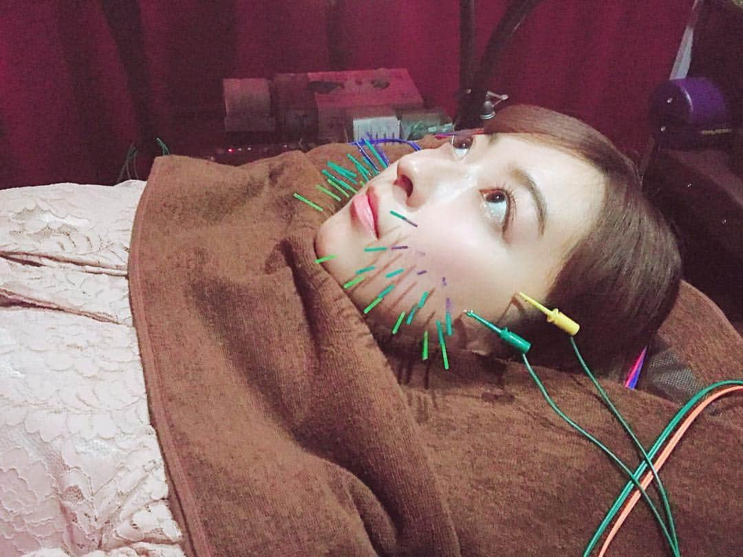 緒方咲さんのインスタグラム写真 - (緒方咲Instagram)「2回目の @b_carat.bykoritorinic さんに 行ってきました💆‍♀️💗 . ゴットハンド杉崎先生( @sugizakikenya )に 小顔にしてもらったよぉ〜(*´ω｀*)✨ . 施術中はBGMがディズニーだったり、お店の雰囲気が 良くてリラックスしちゃう🤤💕 . 美容鍼は痛そうに見えるけど、全然痛くないしすぐに 効果が目に見えてわかるのでオススメだよん🤗❤️❤️ . #杉崎先生 #きゅきゅっと美容鍼 #BCARAT式美容鍼 #BCARATbykoritorinic #BCARAT #Beauty #Body #Balance #笹塚 #笹塚美容鍼 #美容鍼 #美顔鍼 #美容鍼 #美容 #小顔 #美肌 #beauty #photo #happy #instabeauty」3月4日 21時08分 - chaaansaki